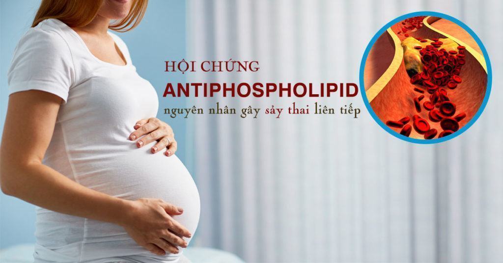 hoi-chung-antiphospholipid-nguyen-nhan-trieu-chung-chan-doan-va-dieu-tri