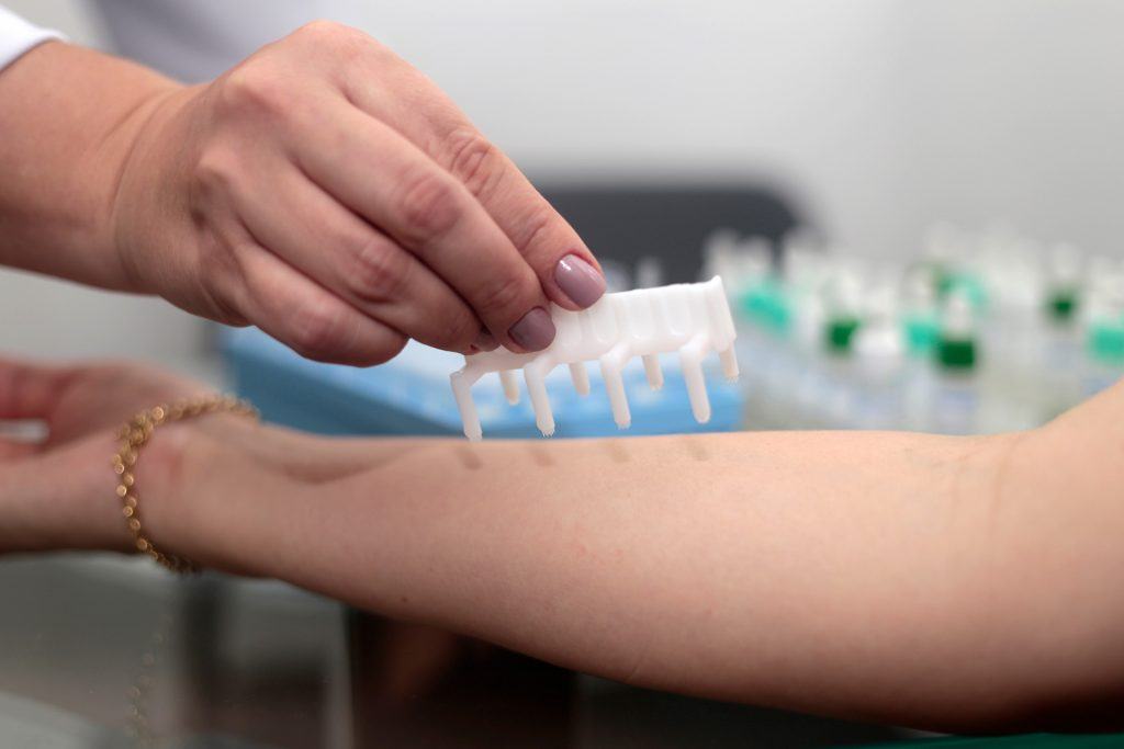 Test lẩy da (Prick test) đặc hiệu với các dị nguyên sữa