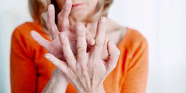 Bệnh viêm đa khớp khiến các ngón tay biến dạng