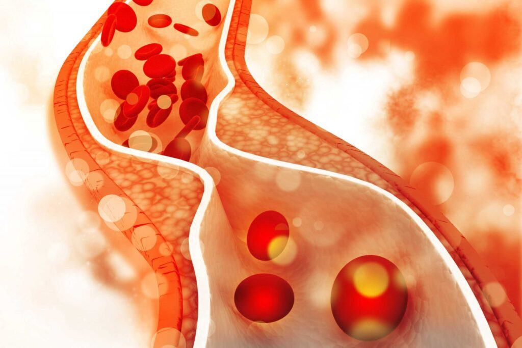 Điều gì tác động tới Cholesterol trong máu?