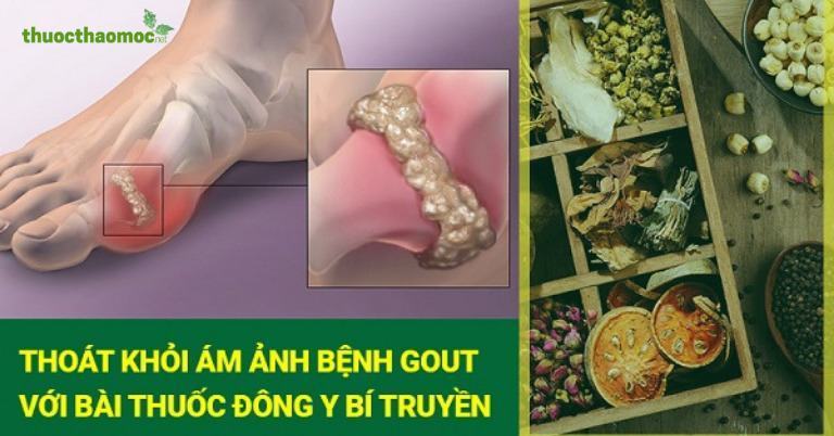 Trà gout Trần Kim Huyền trị được nhiều bệnh