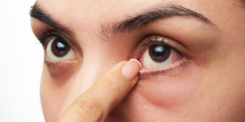 Bệnh đau mắt hột và cách điều trị hiệu quả nhất
