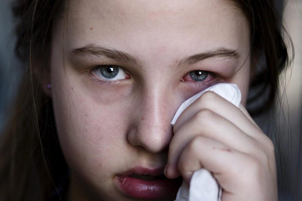 Quá trình bệnh đau mắt đỏ phát triển như thế nào?