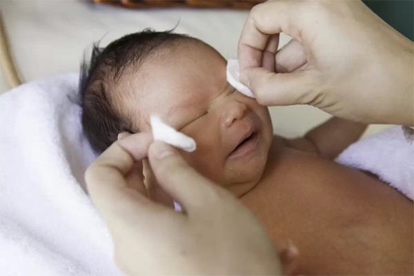 Làm gì khi trẻ sơ sinh bị đau mắt đỏ để giúp con nhanh khỏi bệnh?